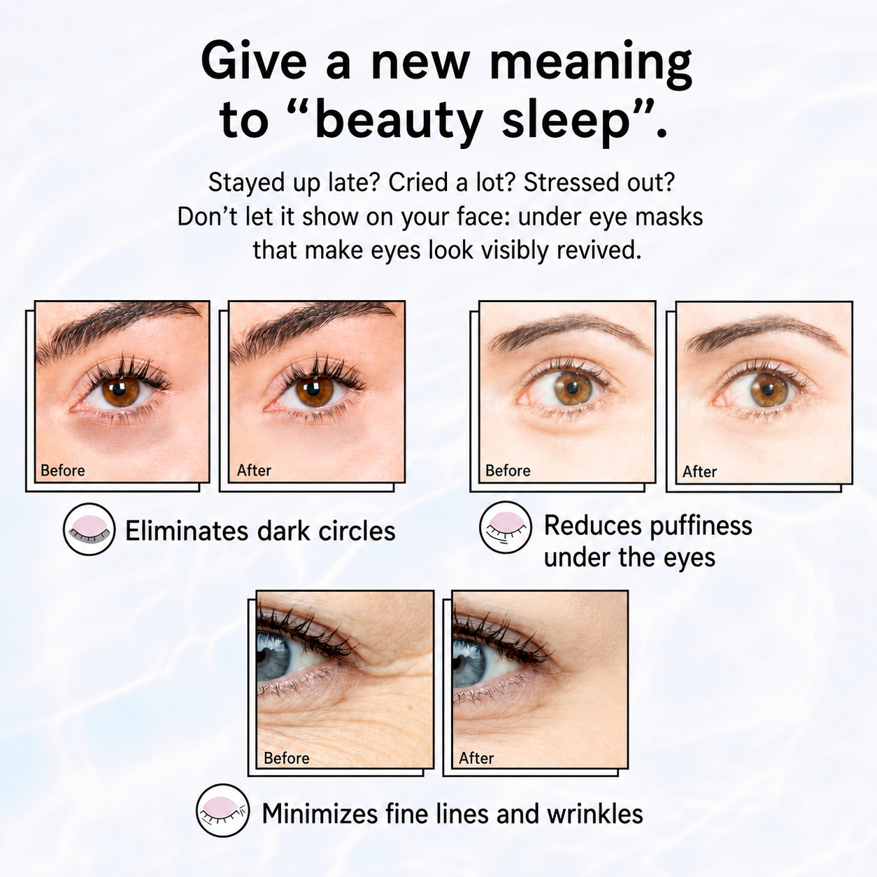 Grace & Stella Retinol Under Eye Patches for Puffy Eyes and Dark Circles